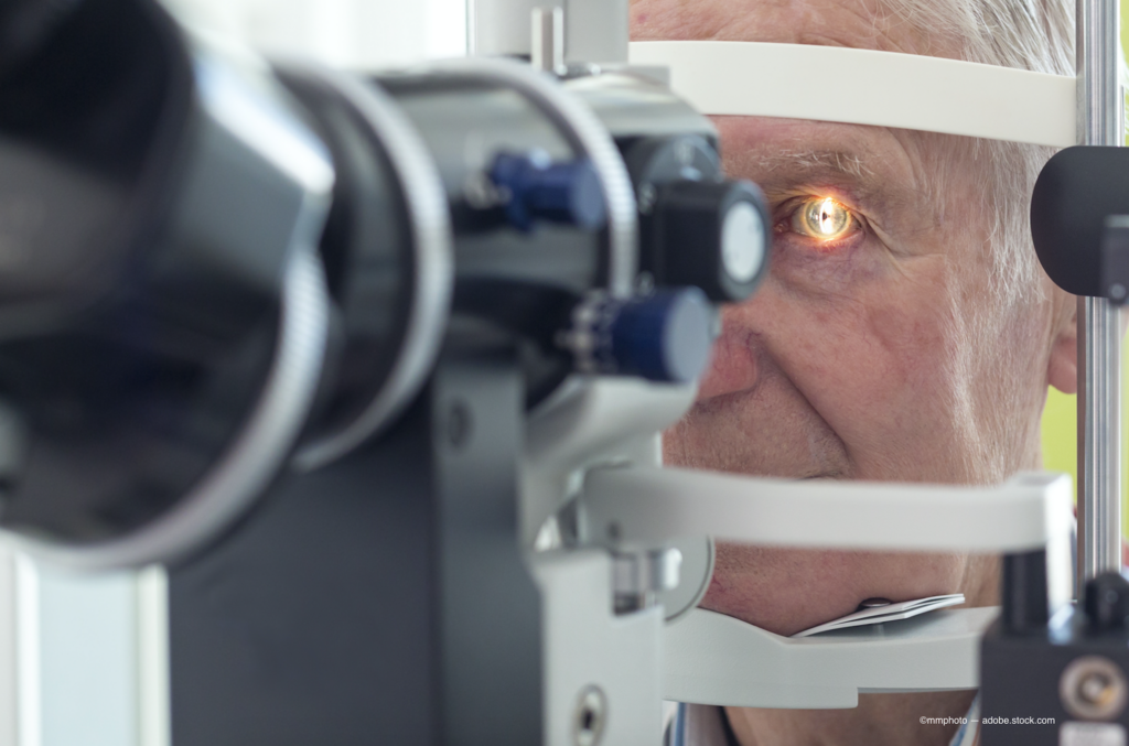 Pre-surgical tips on how to manage cataract